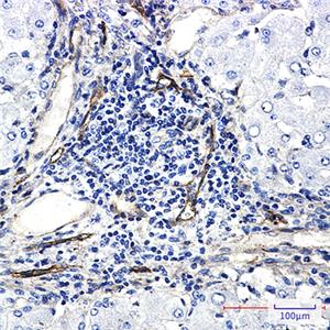 ORAI3兔单抗,ORAI3 Rabbit Monoclonal Antibody
