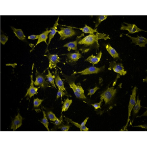 人直肠癌组织源细胞,Human rectal cancer tissue derived cells
