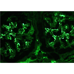 人子宫成纤维细胞