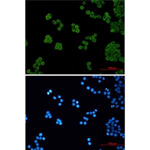 PEN2兔单抗,PEN2 Rabbit Monoclonal Antibody
