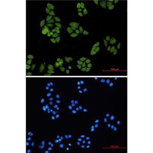 Smad4兔单抗,Smad4 Rabbit Monoclonal Antibody