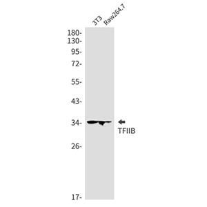Transcription Initiation Factor IIB兔单抗,Transcription Initiation Factor IIB Rabbit Monoclonal Antibody