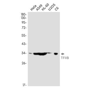 Transcription Initiation Factor IIB兔单抗,Transcription Initiation Factor IIB Rabbit Monoclonal Antibody