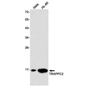 TRAPPC2兔单抗,TRAPPC2 Rabbit Monoclonal Antibody