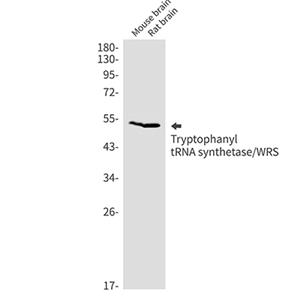 Tryptophan tRNA Ligase兔单抗,Tryptophan tRNA Ligase Rabbit Monoclonal Antibody