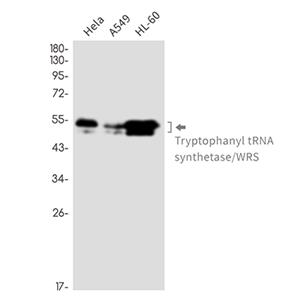 Tryptophan tRNA Ligase兔单抗,Tryptophan tRNA Ligase Rabbit Monoclonal Antibody