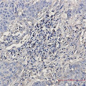 Tryptophan tRNA Ligase兔单抗,Tryptophan tRNA Ligase Rabbit Monoclonal Antibody
