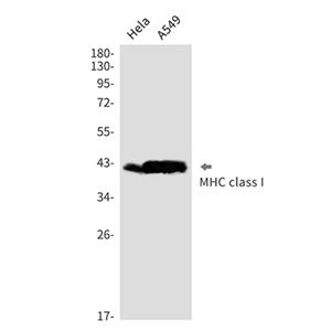 MHC Class I Rabbit Monoclonal Antibody | 兔单抗 | EnkiLife恩玑生命