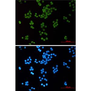 Acetyl-Histone H3 (Lys14)兔单抗,Acetyl-Histone H3 (Lys14) Rabbit Monoclonal Antibody
