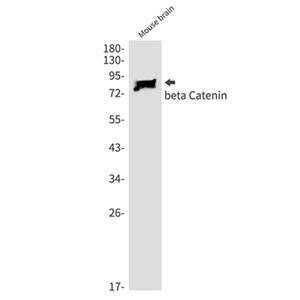 beta Catenin兔单抗,beta Catenin Rabbit Monoclonal Antibody