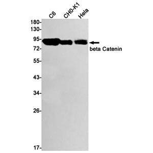 beta Catenin兔单抗,beta Catenin Rabbit Monoclonal Antibody