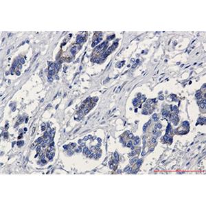 beta Catenin兔单抗,beta Catenin Rabbit Monoclonal Antibody