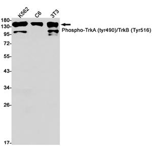 Phospho-TrkA/B (Tyr490/Tyr516)兔单抗,Phospho-TrkA/B (Tyr490/Tyr516) Rabbit Monoclonal Antibody