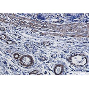 alpha Smooth Muscle Actin兔单抗,alpha Smooth Muscle Actin Rabbit Monoclonal Antibody