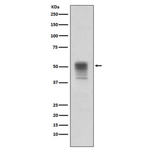Phospho-alpha Tubulin (Tyr272)兔单抗,Phospho-alpha Tubulin (Tyr272) Rabbit Monoclonal Antibody