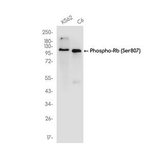 Phospho-Rb (Ser807)兔单抗,Phospho-Rb (Ser807) Rabbit Monoclonal Antibody