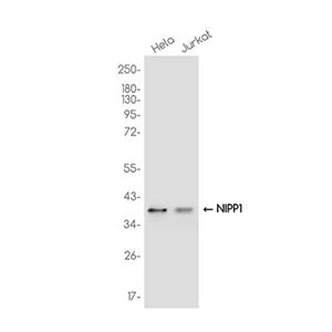 NIPP1兔单抗,NIPP1 Rabbit Monoclonal Antibody