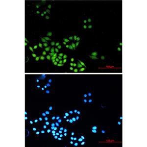 MAD2L2兔单抗,MAD2L2 Rabbit Monoclonal Antibody