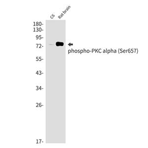 Phospho-PKC alpha (Ser657)兔单抗,Phospho-PKC alpha (Ser657) Rabbit Monoclonal Antibody