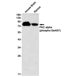Phospho-PKC alpha (Ser657)兔单抗,Phospho-PKC alpha (Ser657) Rabbit Monoclonal Antibody