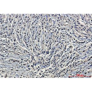Phospho-PKC alpha (Ser657)兔单抗,Phospho-PKC alpha (Ser657) Rabbit Monoclonal Antibody