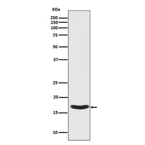 Phospho-alpha Synuclein (S129) (15T7)兔单抗,Phospho-alpha Synuclein (S129) (15T7) Rabbit Monoclonal Antibody