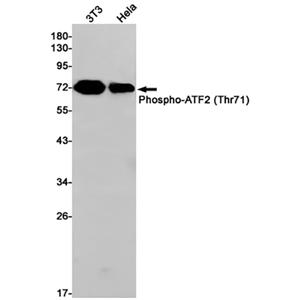 Phospho-ATF2 (T71) (7E18)兔单抗,Phospho-ATF2 (T71) (7E18) Rabbit Monoclonal Antibody