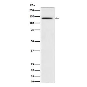Phospho-BCAR1 (Y410) (17X7)兔单抗,Phospho-BCAR1 (Y410) (17X7) Rabbit Monoclonal Antibody