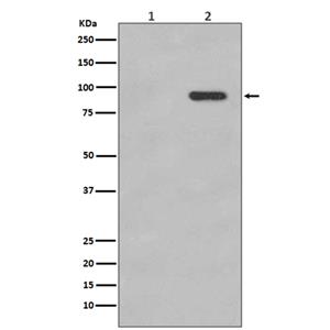 Phospho-beta Catenin (S33/S37) (7V18)兔单抗,Phospho-beta Catenin (S33/S37) (7V18) Rabbit Monoclonal Antibody