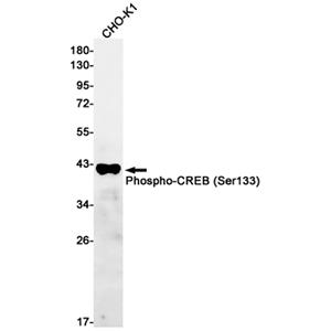 Phospho-CREB (Ser133) (11Z4)兔单抗,Phospho-CREB (Ser133) (11Z4) Rabbit Monoclonal Antibody