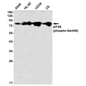 Phospho-eIF4B (Ser406) (13H6)兔单抗,Phospho-eIF4B (Ser406) (13H6) Rabbit Monoclonal Antibody