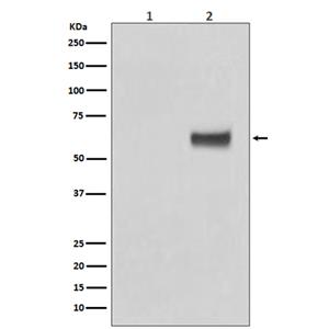 Phospho-ER alpha (S118) (6G16)兔单抗,Phospho-ER alpha (S118) (6G16) Rabbit Monoclonal Antibody