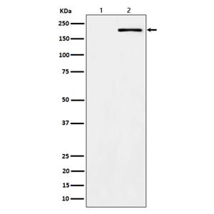 Phospho-ErbB2 (Y1139) (12W6)兔单抗,Phospho-ErbB2 (Y1139) (12W6) Rabbit Monoclonal Antibody