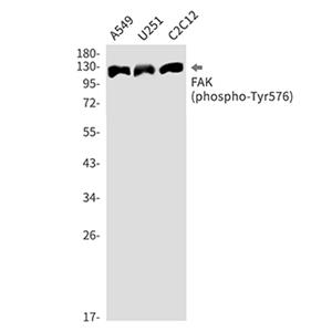 Phospho-FAK (Tyr576) (17X9)兔单抗,Phospho-FAK (Tyr576) (17X9) Rabbit Monoclonal Antibody