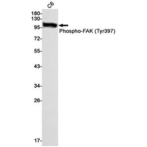 Phospho-FAK (Y397) (10H3)兔单抗,Phospho-FAK (Y397) (10H3) Rabbit Monoclonal Antibody