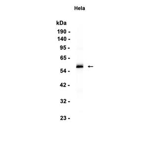 Phospho-IRF3 (S386) (7S3)兔单抗,Phospho-IRF3 (S386) (7S3) Rabbit Monoclonal Antibody