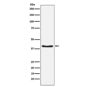 Phospho-PDHA1 (S293) (17H17) Rabbit Monoclonal Antibody | 兔单抗 | EnkiLife恩玑生命