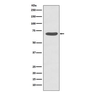 Phospho-PKC zeta (T560) (14P10) Rabbit Monoclonal Antibody | 兔单抗 | EnkiLife恩玑生命