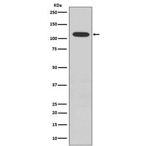 Phospho-Retinoblastoma (S807)  (4H3)兔单抗,Phospho-Retinoblastoma (S807)  (4H3) Rabbit Monoclonal Antibody