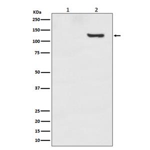Phospho-SIRT1 (T530) (4C14)兔单抗,Phospho-SIRT1 (T530) (4C14) Rabbit Monoclonal Antibody