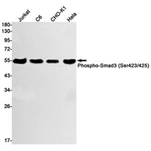 Phospho-Smad3 (Ser423/425) (12O16)兔单抗,Phospho-Smad3 (Ser423/425) (12O16) Rabbit Monoclonal Antibody