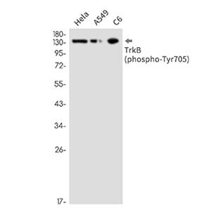 Phospho-TrkB (Tyr705) (3T18)兔单抗,Phospho-TrkB (Tyr705) (3T18) Rabbit Monoclonal Antibody