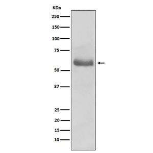 45567(17N4)兔单抗,45567(17N4) Rabbit Monoclonal Antibody
