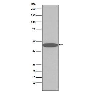 45569(2Y12)兔单抗,45569(2Y12) Rabbit Monoclonal Antibody
