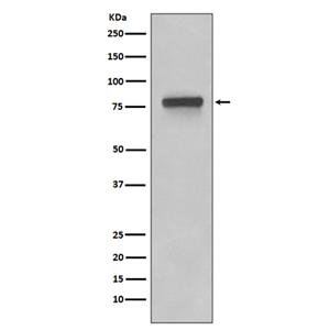 5T4 (9W4)兔单抗,5T4 (9W4) Rabbit Monoclonal Antibody