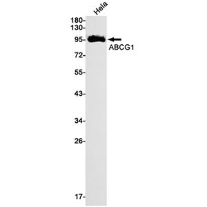 ABCG1 (9S10)兔单抗,ABCG1 (9S10) Rabbit Monoclonal Antibody