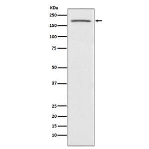 ACE1 (17Q3)兔单抗,ACE1 (17Q3) Rabbit Monoclonal Antibody