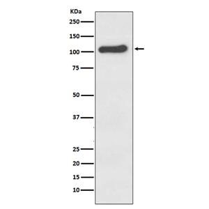 ACE2 (9T7)兔单抗,ACE2 (9T7) Rabbit Monoclonal Antibody