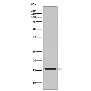 active Caspase-3 (2M18)兔单抗,active Caspase-3 (2M18) Rabbit Monoclonal Antibody