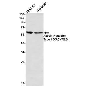 Activin Receptor Type IIB/ACVR2B (2S5)兔单抗,Activin Receptor Type IIB/ACVR2B (2S5) Rabbit Monoclonal Antibody